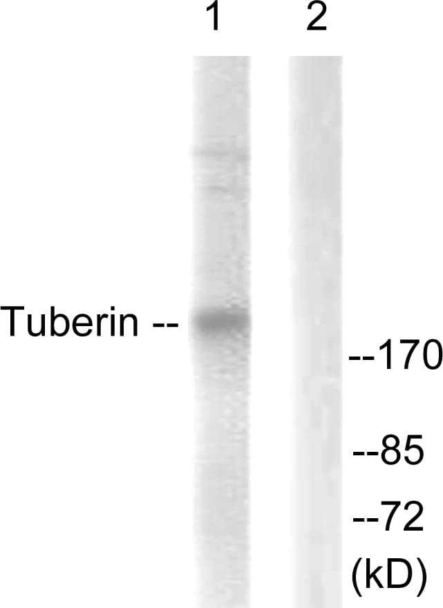 Tuberin / TSC2 Antibody (aa905-954)