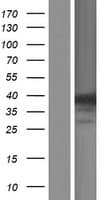 ANKRD9 Protein (Over-Expression Lysate Myc-DDK (Flag))