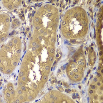 FAK / Focal Adhesion Kinase Antibody