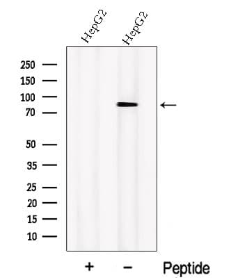 Polyclonal Rabbit anti-Human ALDH18A1 Antibody (WB)