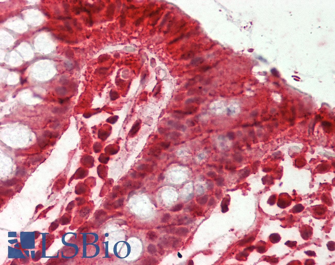 IHC-plus™ ITGB1 / Integrin Beta 1 / CD29 Antibody (aa650-700)