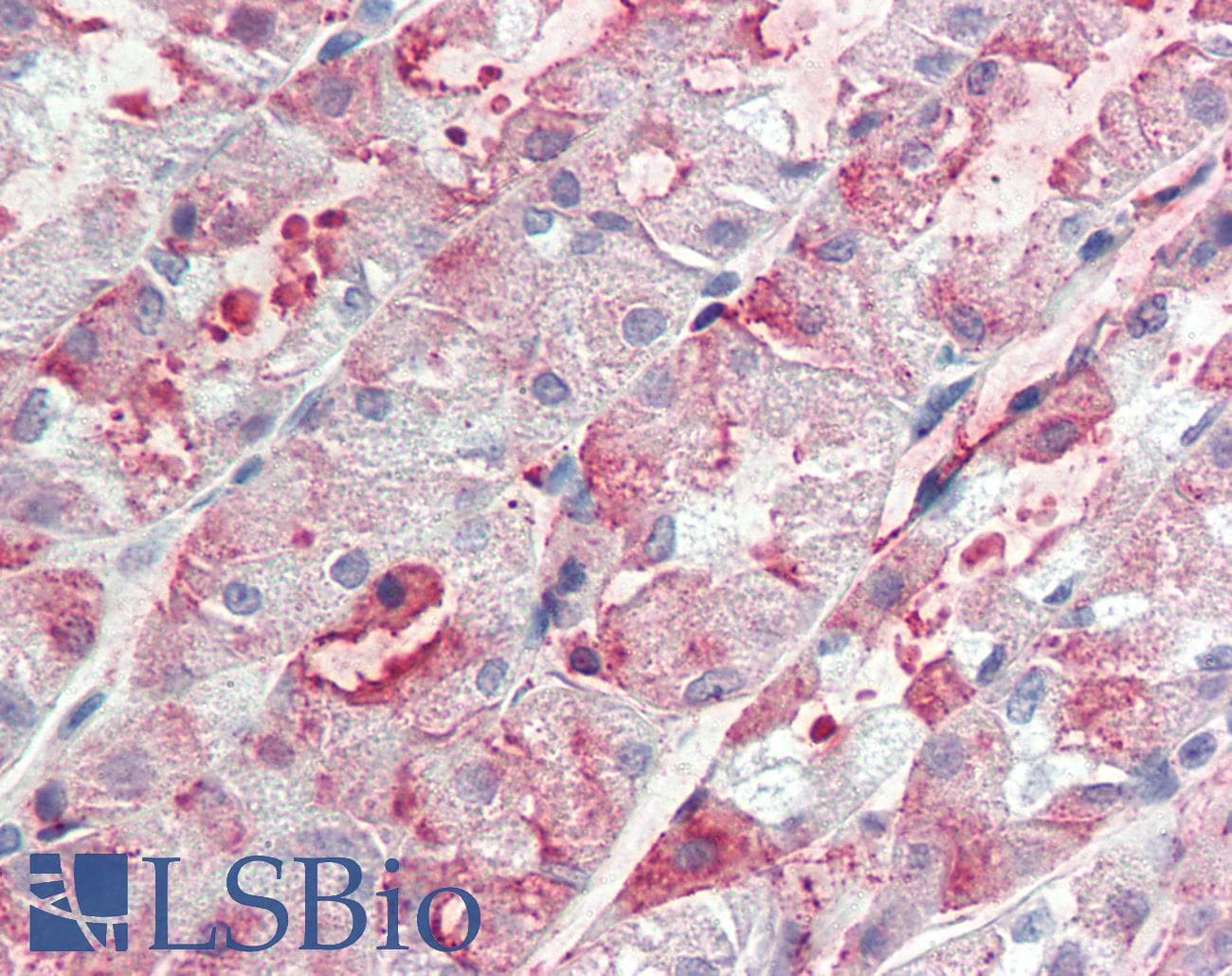 IHC-plus™ Polyclonal Rabbit anti-Human ITGA6/Integrin Alpha 6/CD49f Antibody (Internal, IHC)