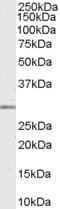 IHC-plus™ MMP7 / Matrilysin Antibody (aa255-267)