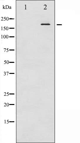 IRS1 Antibody (phospho-Ser307)