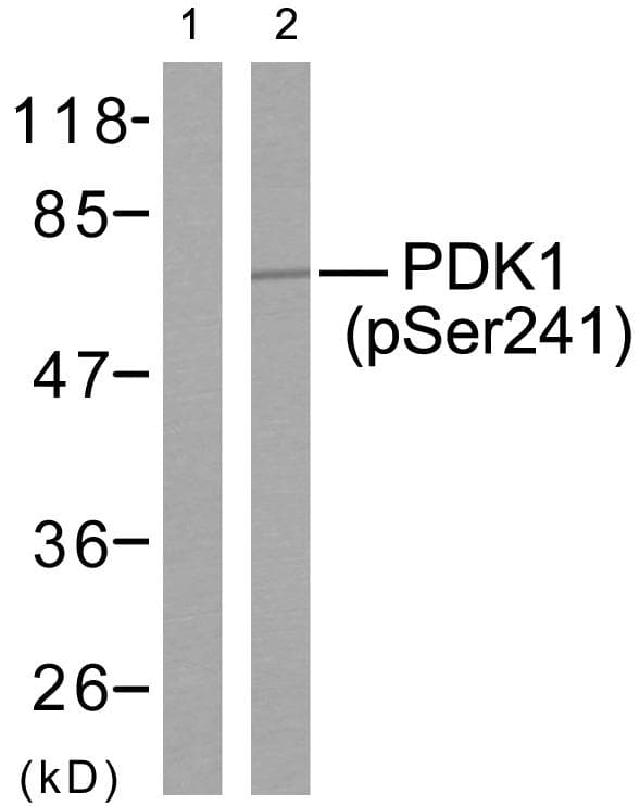 PDPK1 / PDK1 Antibody (phospho-Ser241)
