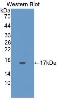 HEXB Antibody (aa100-216)