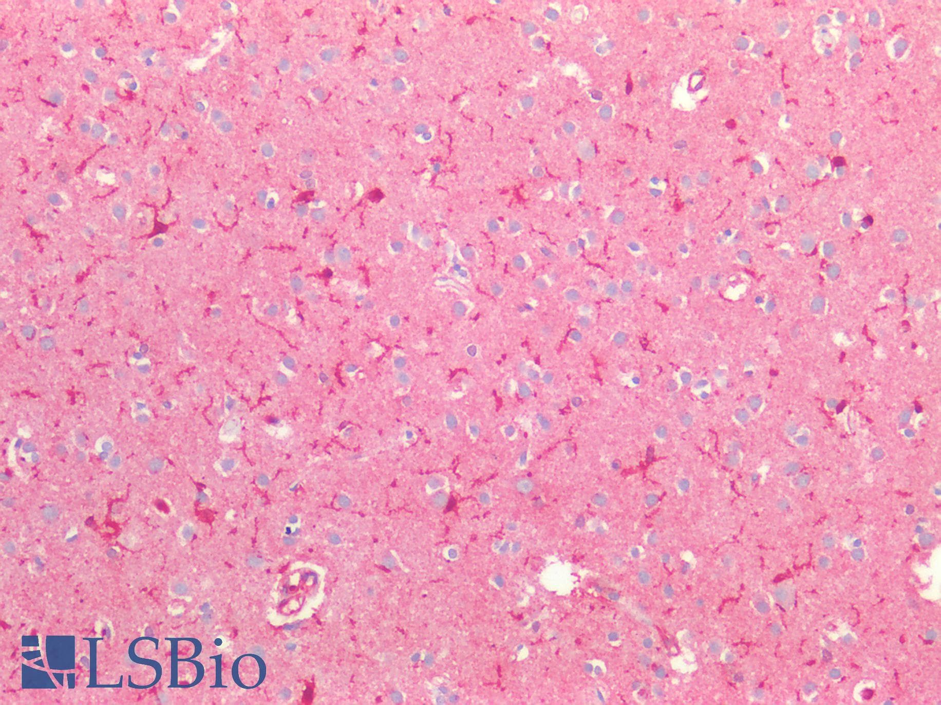 IHC-plus™ Polyclonal Rabbit anti-Human OPRL1 / ORL1 Antibody (IHC, WB)