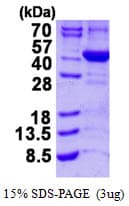 Human ALAD Protein (Recombinant His)