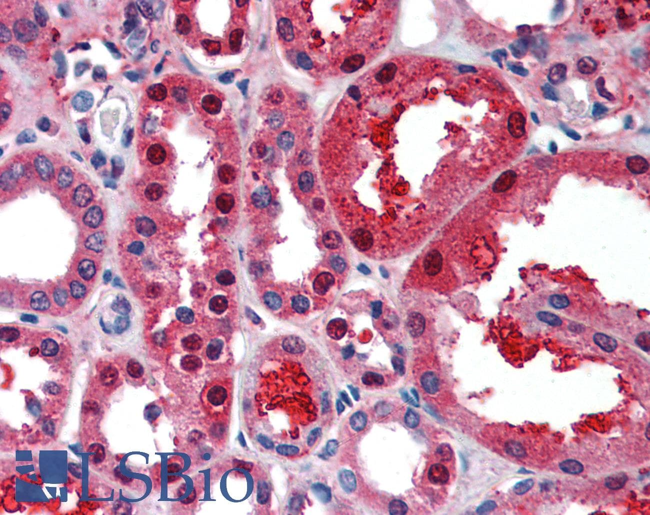 TCF21 / Epicardin Antibody (aa42-91)