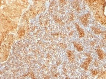 CYCS / Cytochrome c Antibody (aa66-104, clone SPM389)