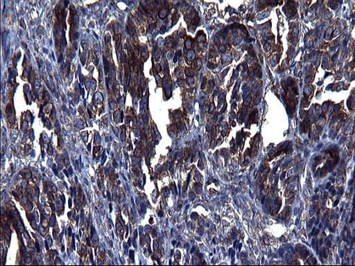 TUBA1A / Tubulin Alpha 1a Antibody (clone OTI2C8)