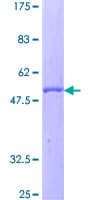 Human CFD / Factor D / Adipsin Protein (Recombinant GST)