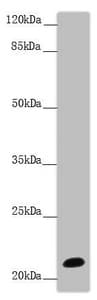 NCALD / Neurocalcin Delta Antibody