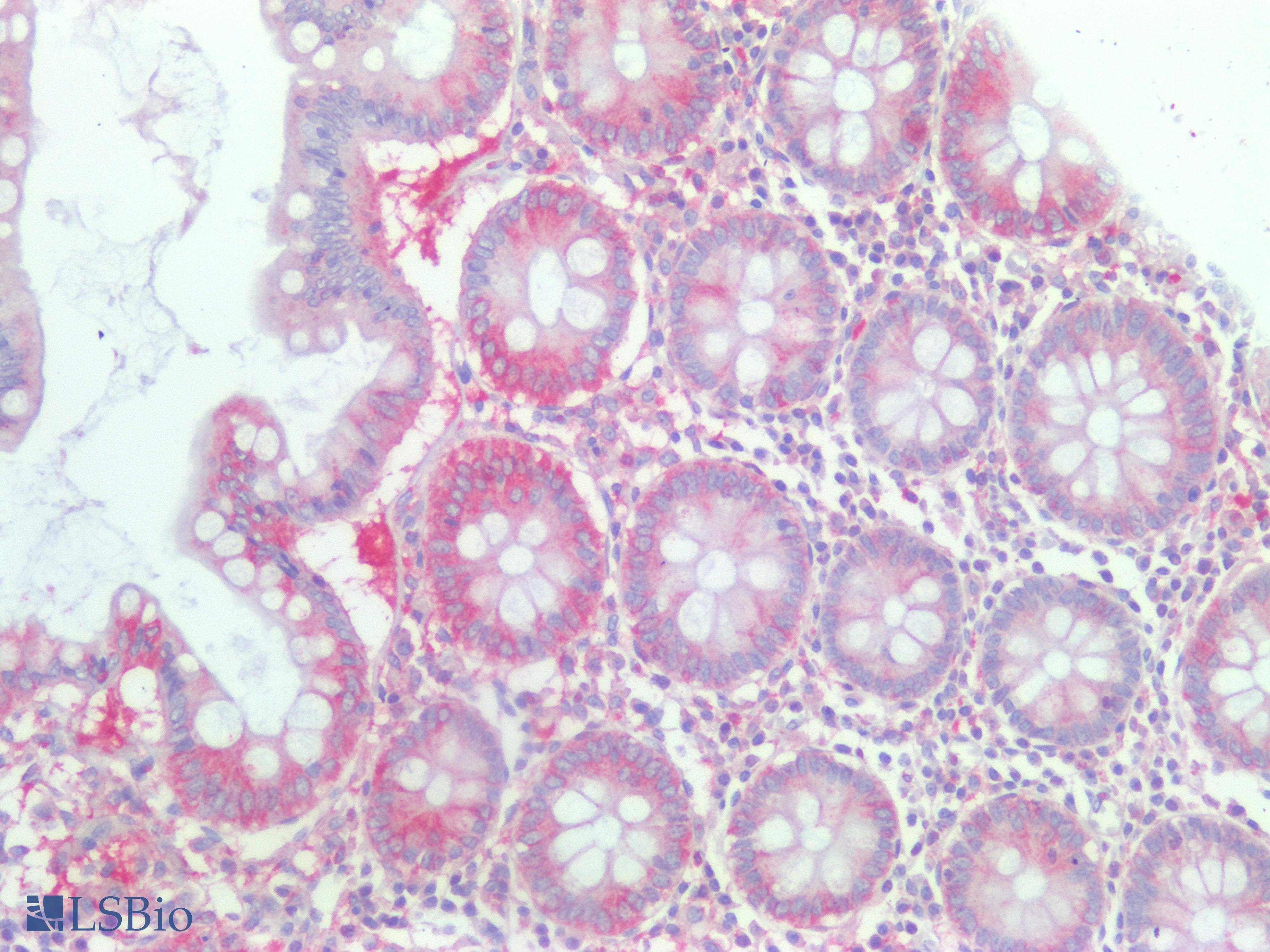 PathPlus™ Kinesin Heavy Chain / KIF5B Antibody