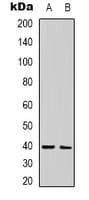 CALHM1 Antibody