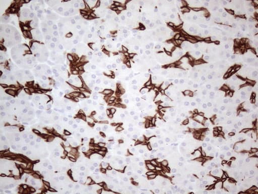 KRT16 / CK16 / Cytokeratin 16 Antibody (clone OTI2H8)
