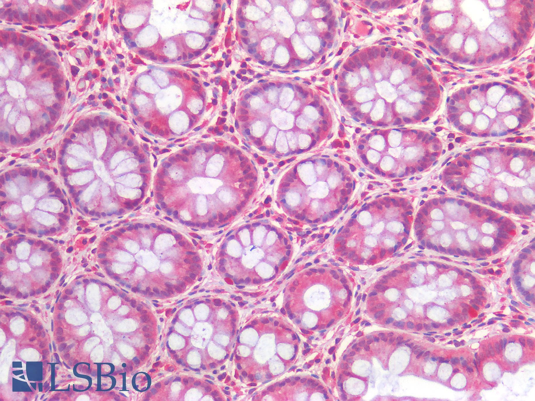 IHC-plus™ Polyclonal Rabbit anti-Human IGF1R / IGF1 Receptor Antibody (IHC)
