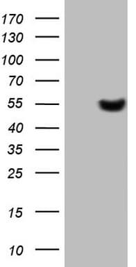 LRRC6 Antibody (clone OTI1D4)
