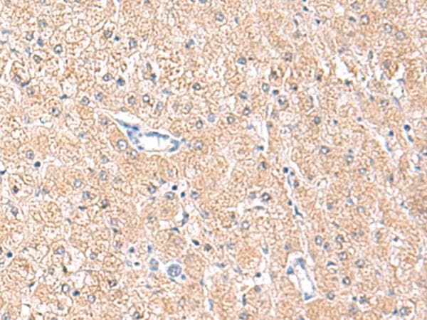 Polyclonal Rabbit anti-Human MLKL Antibody (IHC)