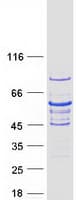 Human GRB14 Protein (Recombinant Myc-DDK (Flag))