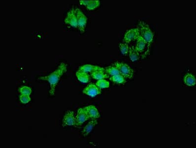 MTX2 Antibody