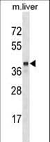 SEC14L2 Antibody (aa41-69)