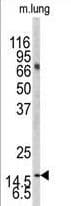 Polyclonal Rabbit anti-Human MAP1LC3B / LC3B Antibody (aa23-52, IHC, WB)