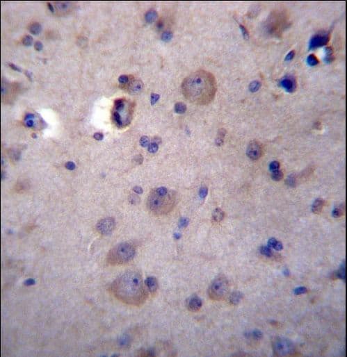 Heparanase 2 / HPSE2 Antibody (aa451-480)