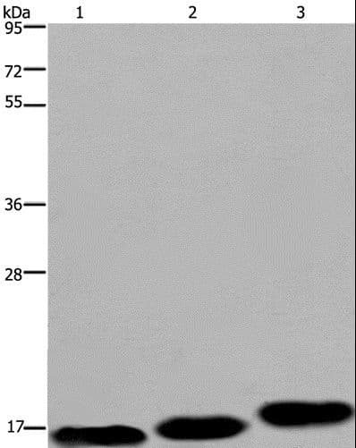 Polyclonal Rabbit anti-Human MRLC2 / MYL12B Antibody (IHC, WB)