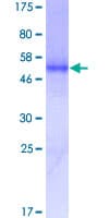 Human PDGFRA / PDGFR Alpha Protein (Recombinant GST)