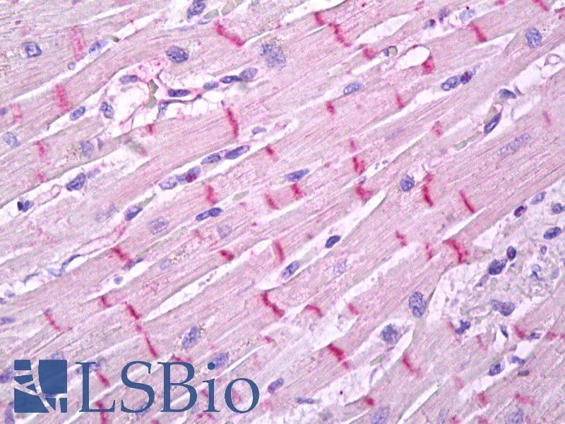 IHC-plus™ GPR17 Antibody (aa353-366)