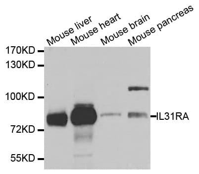 Polyclonal Rabbit anti-Human IL31RA Antibody (WB)