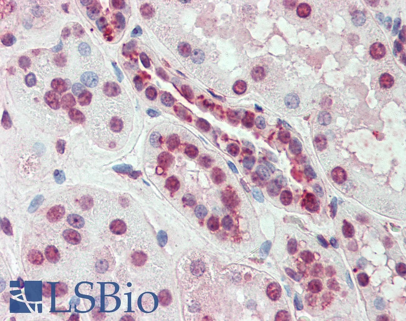IHC-plus™ SLC44A2 / CTL2 Antibody (Internal)