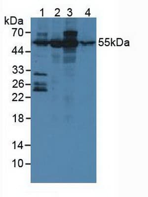 ATXN10 / SCA10 Antibody (aa116-302, APC)