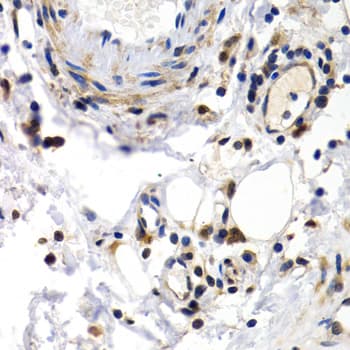 PKLR Antibody