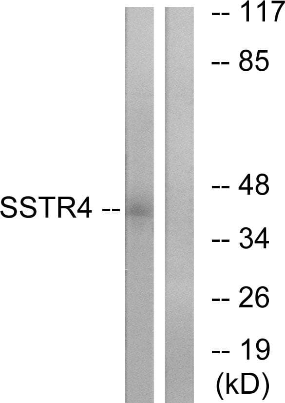 SSTR4 Antibody