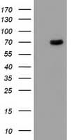 Monoclonal Mouse anti-Human BCHE / Cholinesterase Antibody (clone OTI1E1, WB)