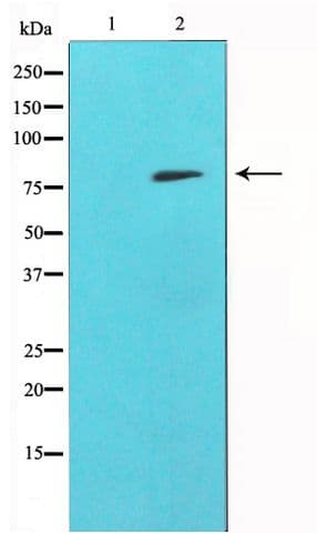 MMP9 / Gelatinase B Antibody