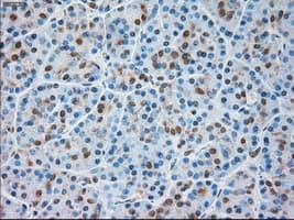 TRPM4 Antibody (clone OTI10H5)