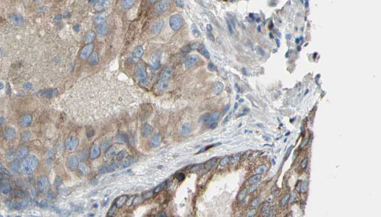 CHKA / CK / Choline Kinase Antibody