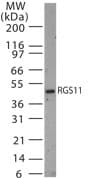 Polyclonal Rabbit anti-Human RGS11 Antibody (aa201-218, WB)