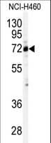 CSTF2 / CstF-64 Antibody (aa31-60)