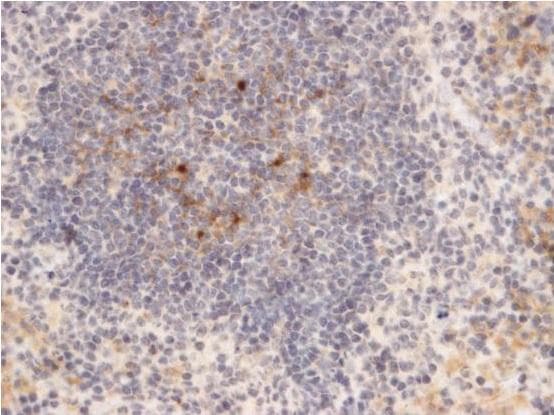 ADGRE1 / EMR1 Antibody