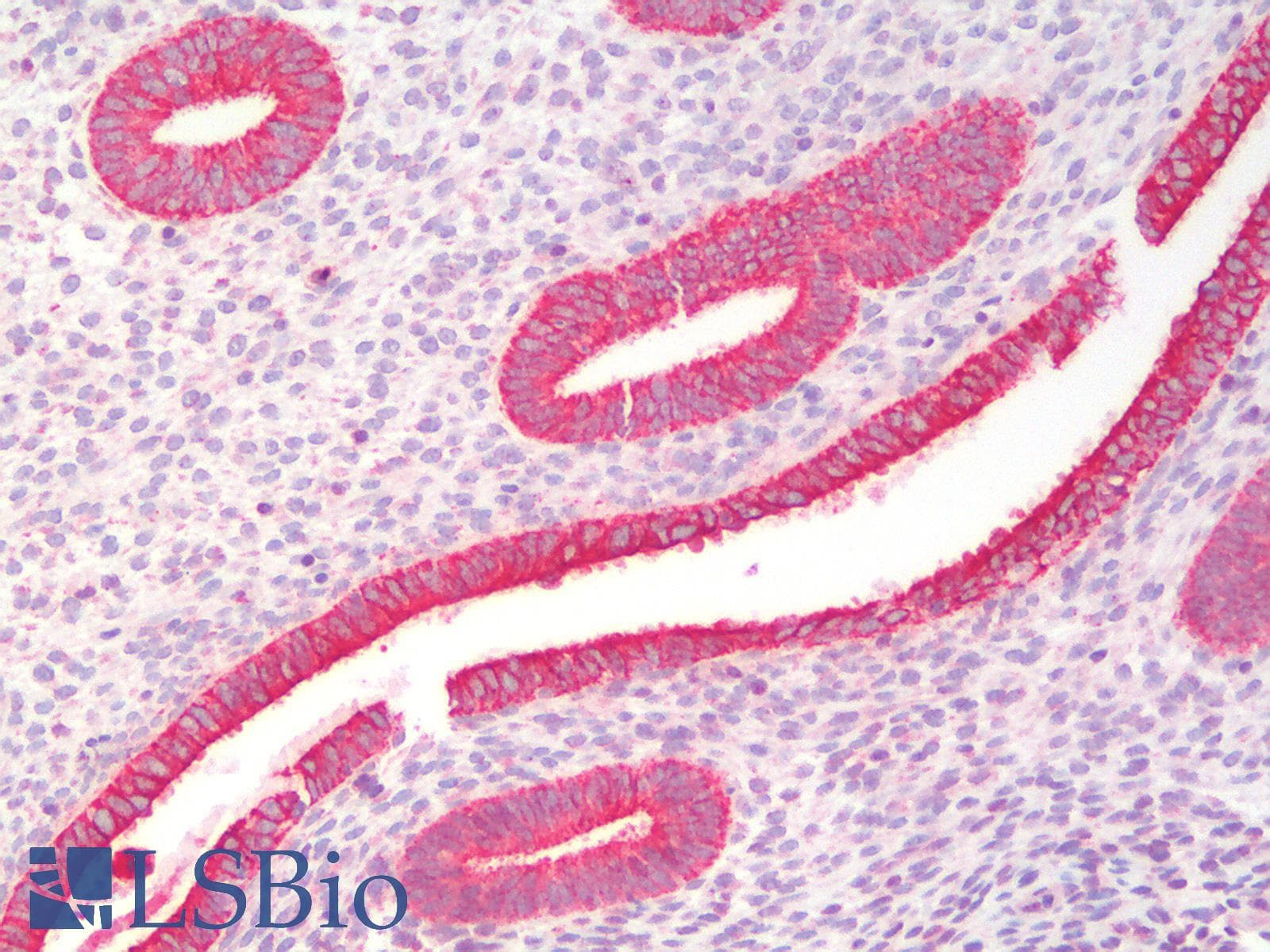 PathPlus™ KRT19 / CK19 / Cytokeratin 19 Antibody
