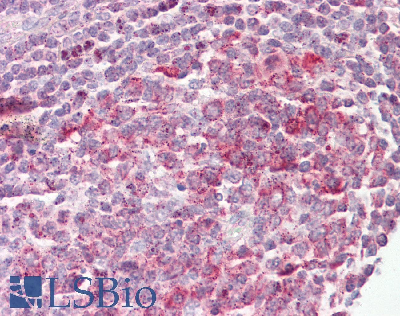 IHC-plus™ MRPL23 Antibody