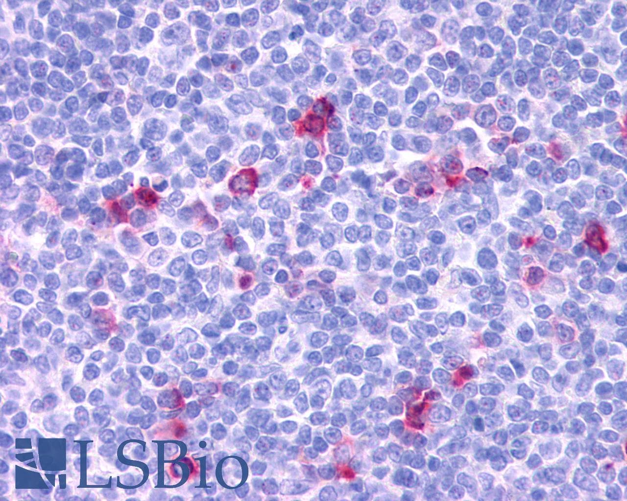 PathPlus™ CCR3 Antibody (Extracellular Domain)
