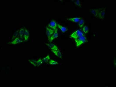 IHC-plus™ RAP1A Antibody