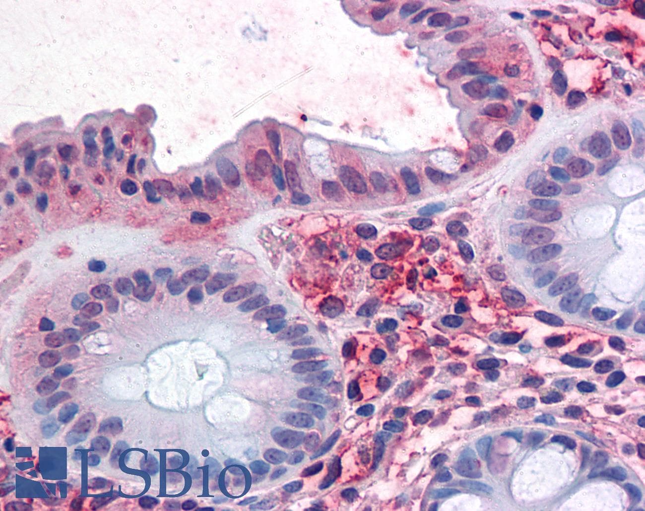 IHC-plus™ SLC1A5 / ASCT2 Antibody (Internal)