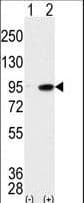Polyclonal Rabbit anti-Human MAK Antibody (aa578-608, IHC, WB)