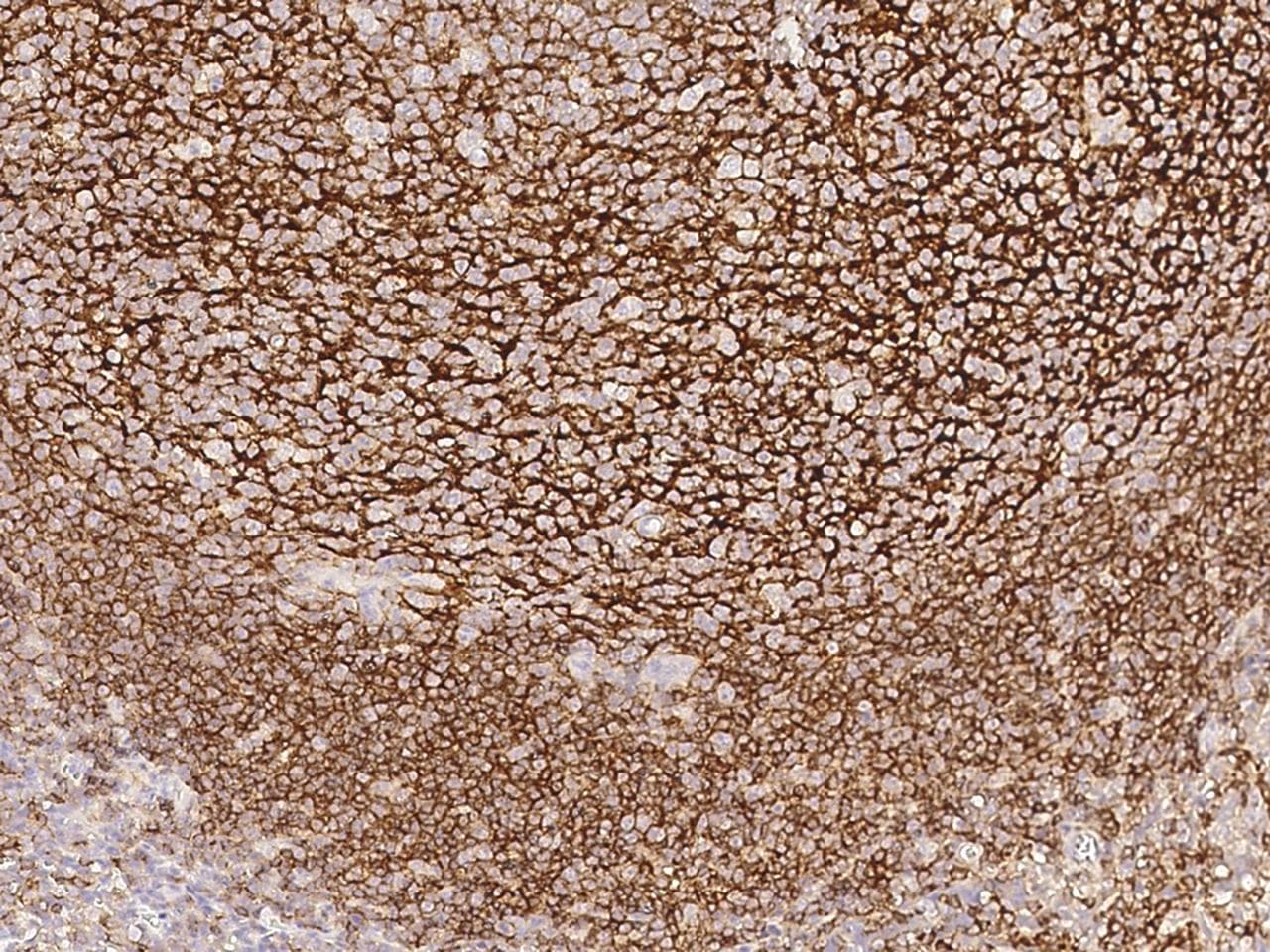 Monoclonal Mouse anti-Human CR2 / CD21 Antibody (clone 28, Preservative Free, IHC)